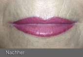images/Referenzen/lippen/Foto_A_8.png